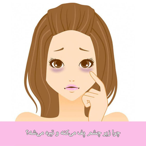 چرا زیر چشم پف می‌کنه و تیره می‌شه؟